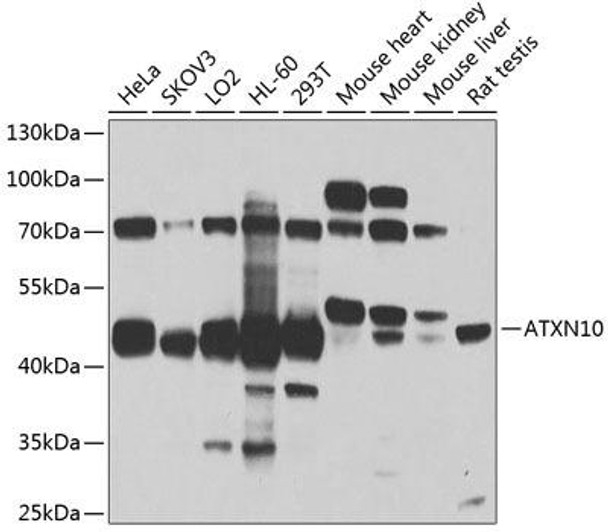 Cell Biology Antibodies 9 Anti-ATXN10 Antibody CAB4586