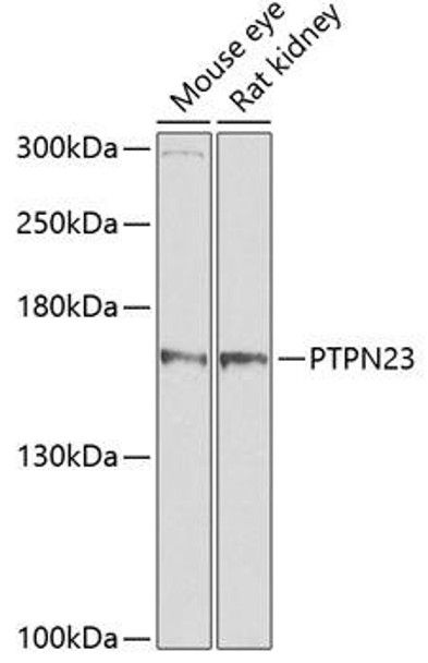 Cell Biology Antibodies 9 Anti-PTPN23 Antibody CAB4595