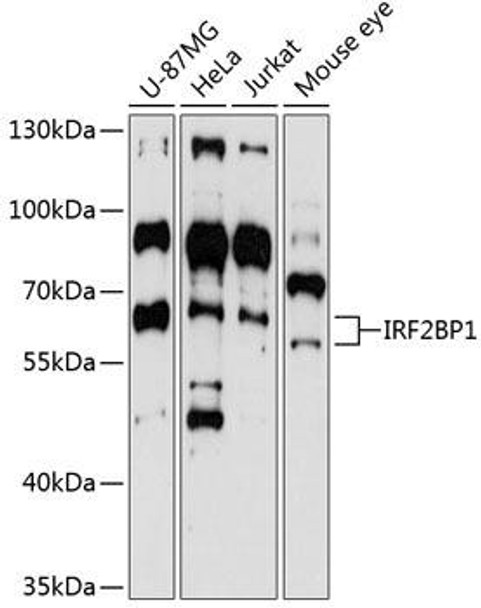 Epigenetics and Nuclear Signaling Antibodies 3 Anti-IRF2BP1 Antibody CAB4614