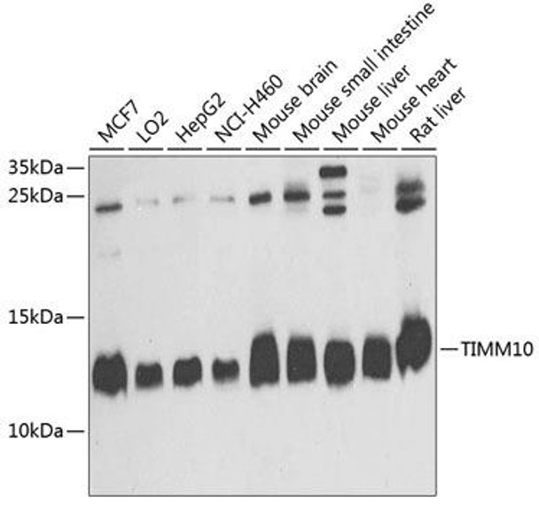 Cell Biology Antibodies 9 Anti-TIMM10 Antibody CAB4626