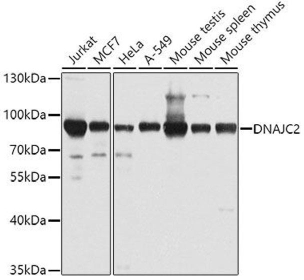 Epigenetics and Nuclear Signaling Antibodies 3 Anti-DNAJC2 Antibody CAB4633