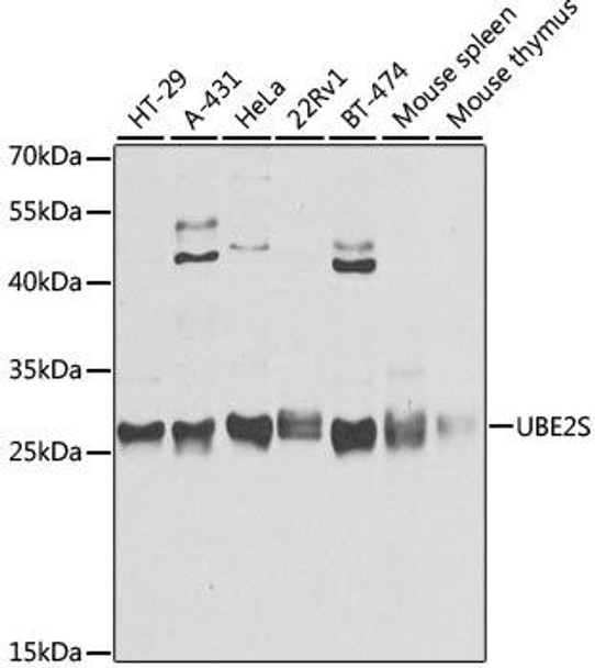 Cell Cycle Antibodies 1 Anti-UBE2S Antibody CAB4658