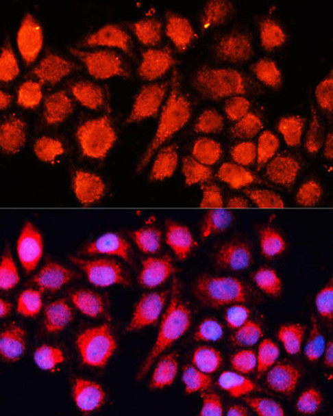 Epigenetics and Nuclear Signaling Antibodies 3 Anti-MRPS28 Antibody CAB4660