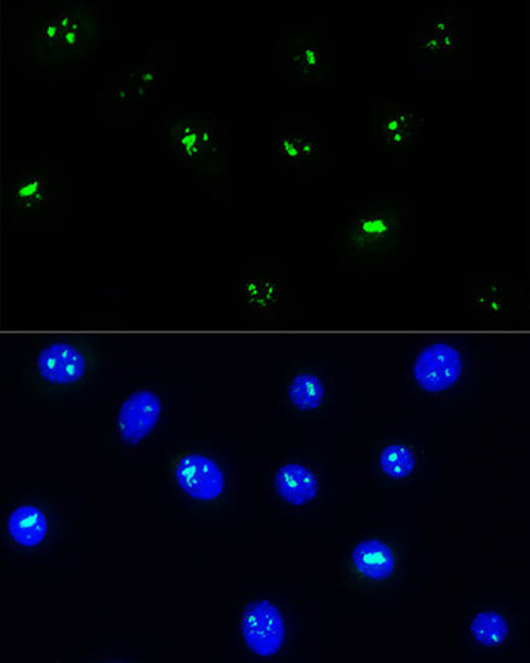 Cell Biology Antibodies 9 Anti-NOP58 Antibody CAB4749