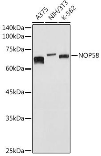 Cell Biology Antibodies 9 Anti-NOP58 Antibody CAB4749