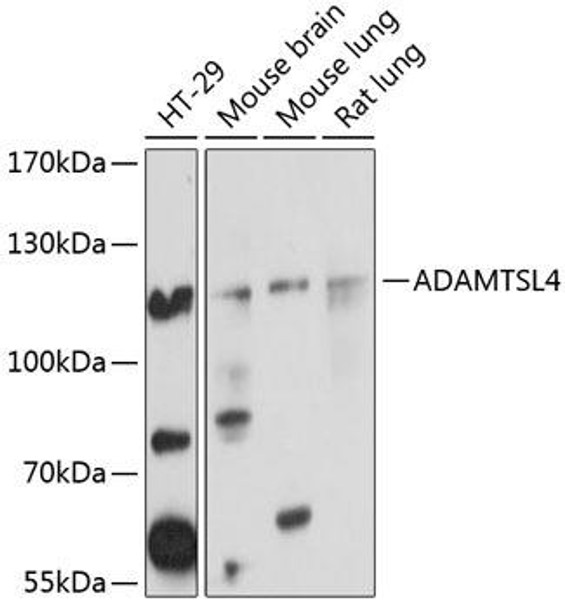 Cell Death Antibodies 2 Anti-ADAMTSL4 Antibody CAB4785