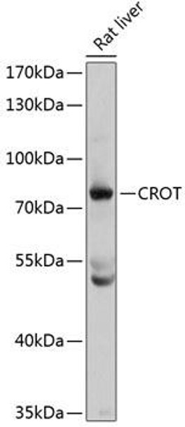 Metabolism Antibodies 2 Anti-CROT Antibody CAB4790