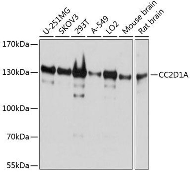 Epigenetics and Nuclear Signaling Antibodies 3 Anti-CC2D1A Antibody CAB4800