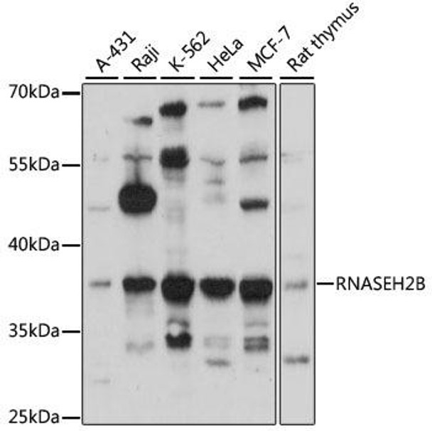 Cell Biology Antibodies 9 Anti-RNASEH2B Antibody CAB4972