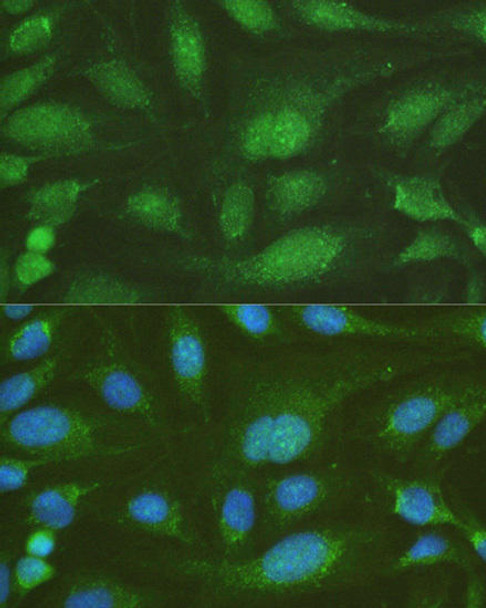 Epigenetics and Nuclear Signaling Antibodies 3 Anti-NHEJ1 Antibody CAB4985