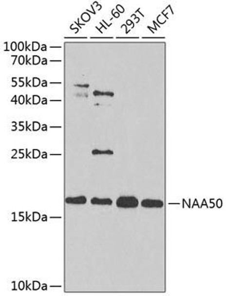 Cell Biology Antibodies 9 Anti-NAA50 Antibody CAB4996