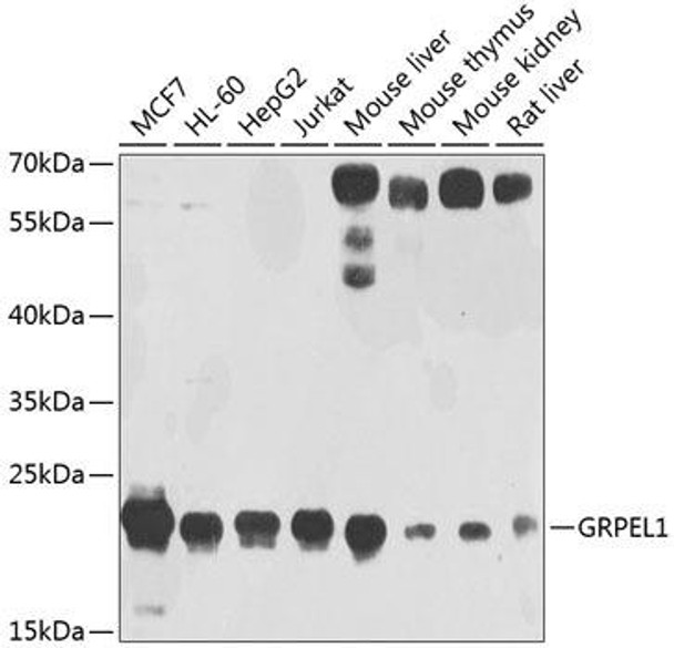Cell Biology Antibodies 9 Anti-GRPEL1 Antibody CAB4999