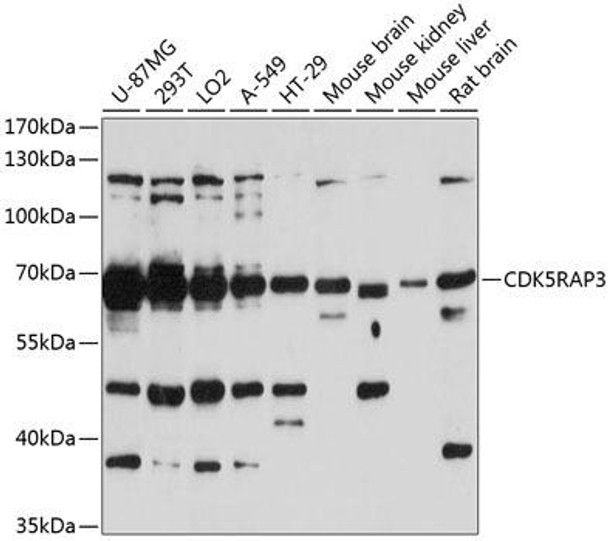 Immunology Antibodies 2 Anti-CDK5RAP3 Antibody CAB5000