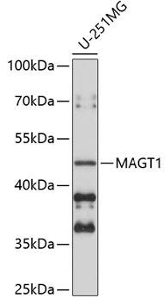 Signal Transduction Antibodies 2 Anti-MAGT1 Antibody CAB5039