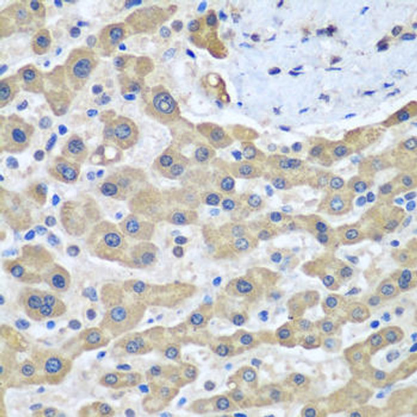 Metabolism Antibodies 2 Anti-GFM1 Antibody CAB5077