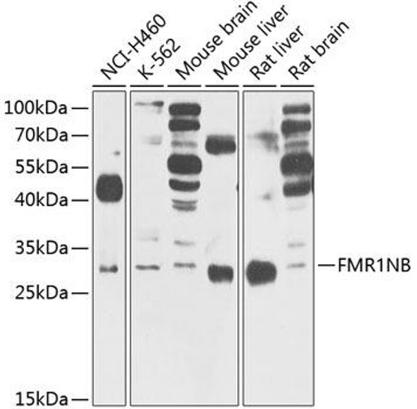 Cell Biology Antibodies 9 Anti-FMR1NB Antibody CAB5183