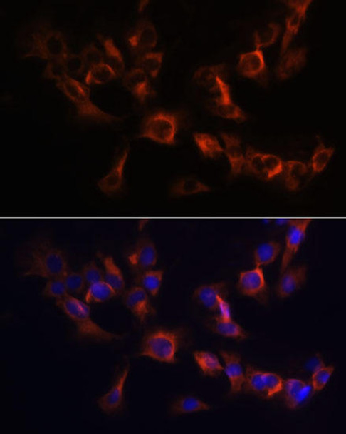 Cell Biology Antibodies 9 Anti-ARL13B Antibody CAB5200