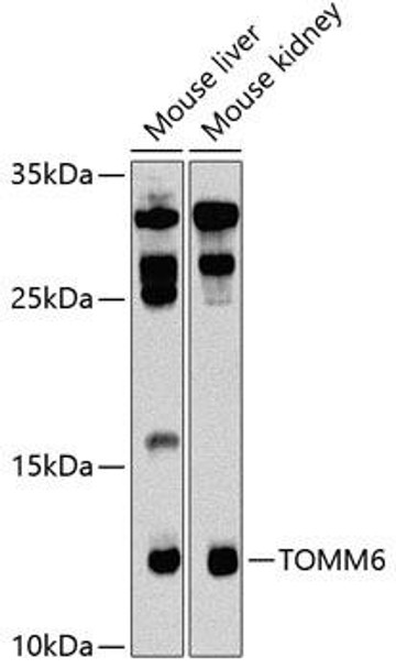 Cell Biology Antibodies 9 Anti-TOMM6 Antibody CAB5240