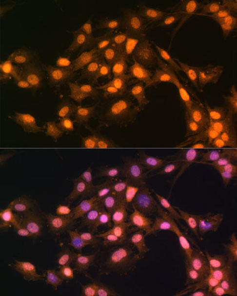 Cell Biology Antibodies 9 Anti-Snail Antibody CAB5243