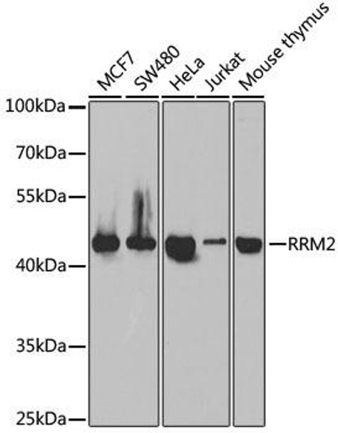 Epigenetics and Nuclear Signaling Antibodies 3 Anti-RRM2 Antibody CAB5255