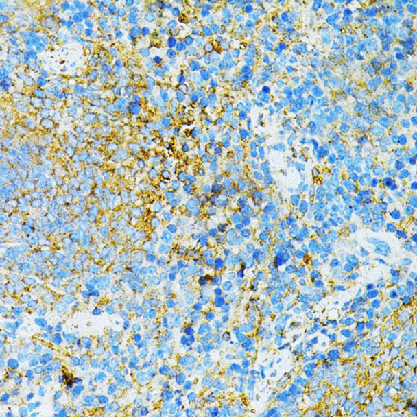 Immunology Antibodies 2 Anti-TLR4 Antibody CAB5258