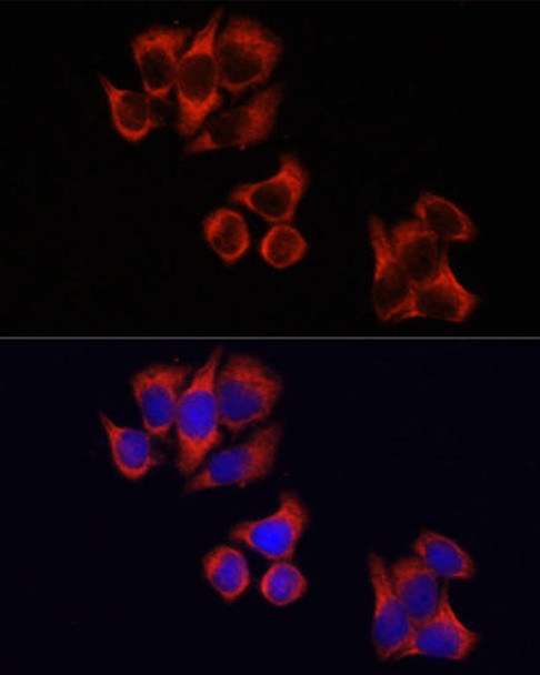 Immunology Antibodies 2 Anti-TLR4 Antibody CAB5258