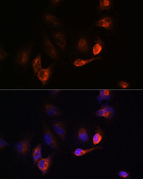 Cell Biology Antibodies 9 Anti-BACE1 Antibody CAB5266