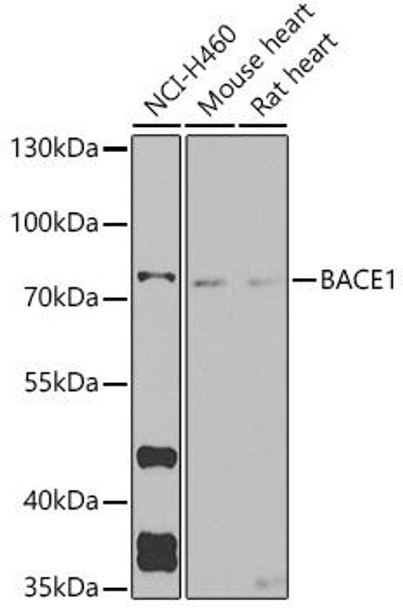 Cell Biology Antibodies 9 Anti-BACE1 Antibody CAB5266