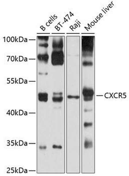 Immunology Antibodies 2 Anti-CXCR5 Antibody CAB5268