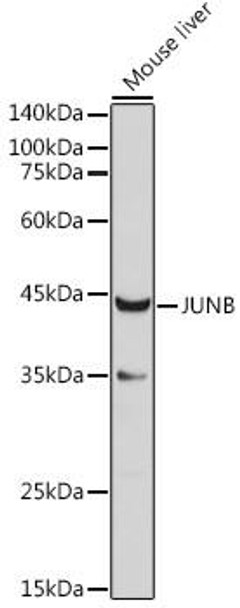Epigenetics and Nuclear Signaling Antibodies 3 Anti-JUNB Antibody CAB5290