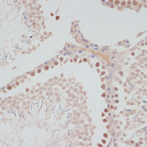 Cell Cycle Antibodies 1 Anti-Cyclin G1 Antibody CAB5292