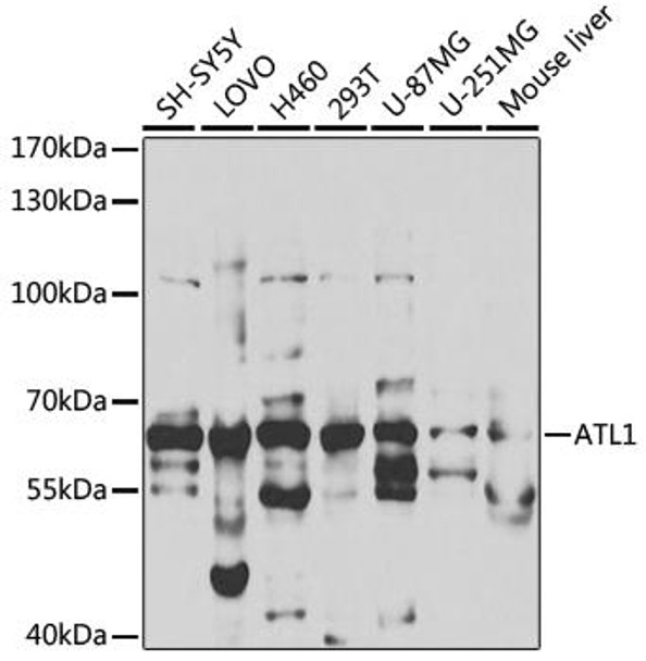 Cell Biology Antibodies 9 Anti-ATL1 Antibody CAB5302