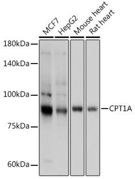 Metabolism Antibodies 2 Anti-CPT1A Antibody CAB5307