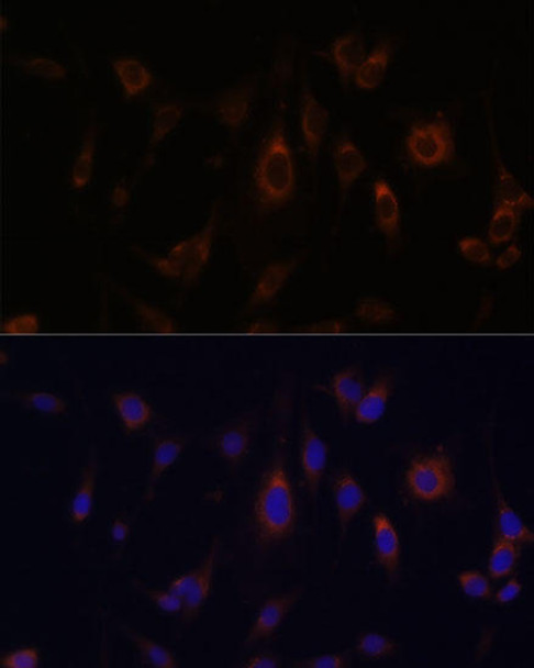 Cell Biology Antibodies 9 Anti-GLRX Antibody CAB5315