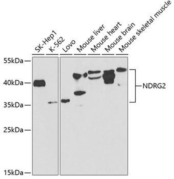 Developmental Biology Anti-NDRG2 Antibody CAB5319