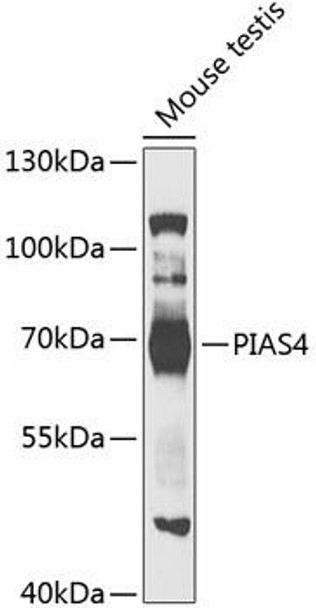 Epigenetics and Nuclear Signaling Antibodies 3 Anti-PIAS4 Antibody CAB5322