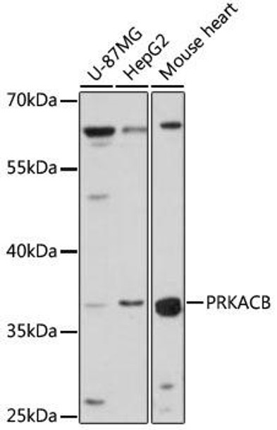 Cell Biology Antibodies 9 Anti-PRKACB Antibody CAB5324