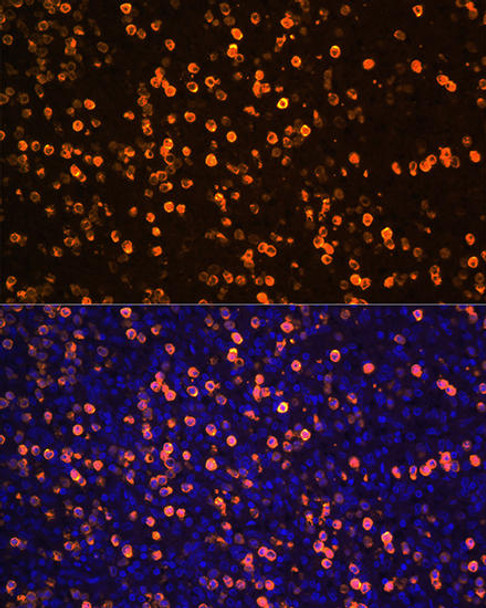 Immunology Antibodies 2 Anti-S100A12 Antibody CAB5328