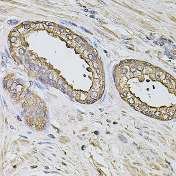 Immunology Antibodies 2 Anti-S100A12 Antibody CAB5328