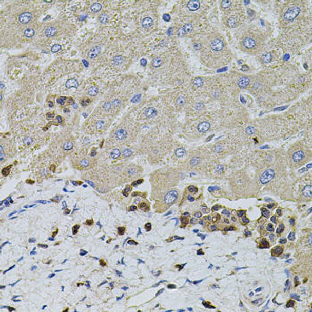 Immunology Antibodies 2 Anti-S100A12 Antibody CAB5328