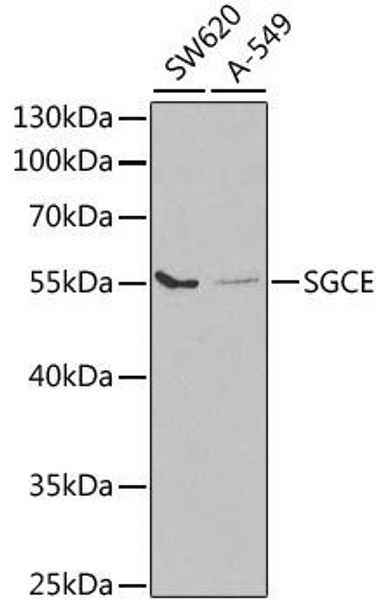 Cell Biology Antibodies 9 Anti-SGCE Antibody CAB5330