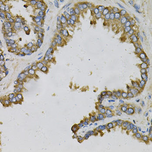 Cardiovascular Antibodies Anti-EFNA1 Antibody CAB5341