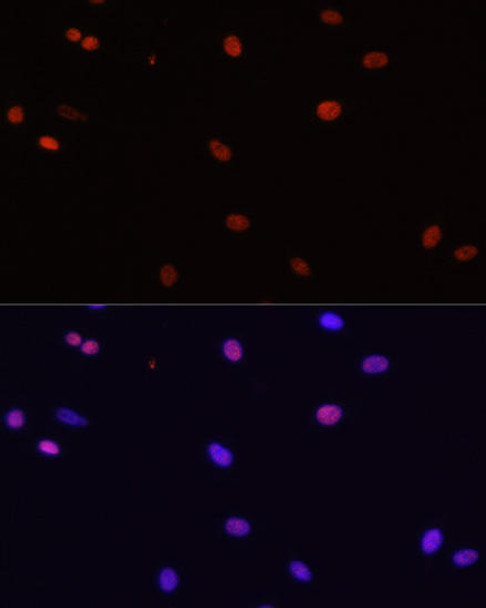 Epigenetics and Nuclear Signaling Antibodies 3 Anti-HDGF Antibody CAB5347