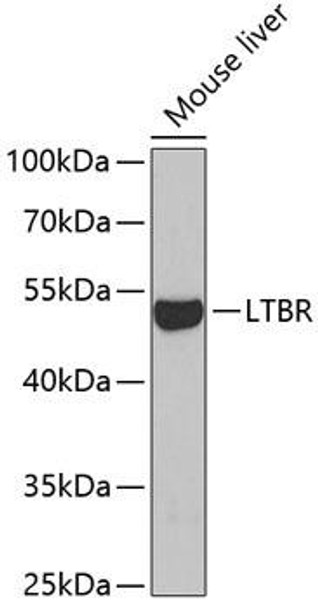 Cell Death Antibodies 2 Anti-LTBR Antibody CAB5351