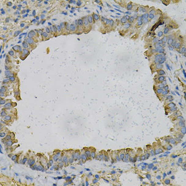 Cell Cycle Antibodies 1 Anti-NEK2 Antibody CAB5355