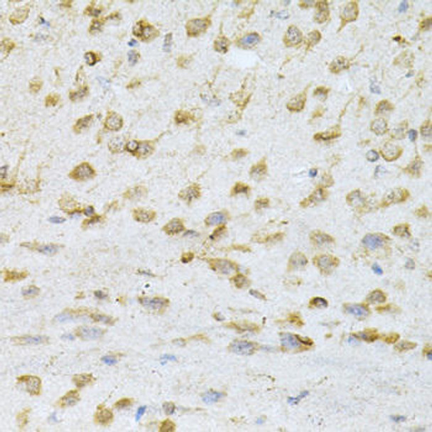 Immunology Antibodies 2 Anti-VAPB Antibody CAB5363