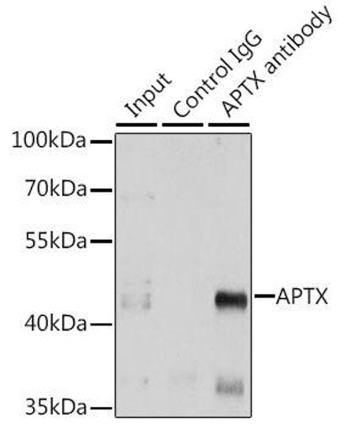 Epigenetics and Nuclear Signaling Antibodies 3 Anti-APTX Antibody CAB5364