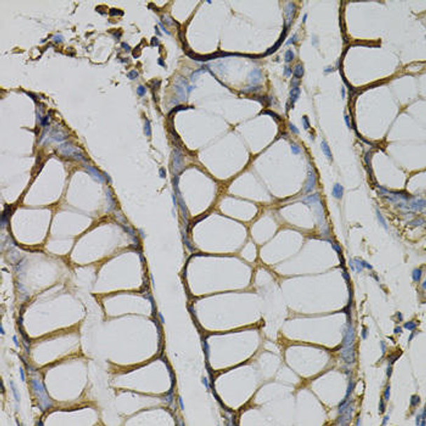 Cell Biology Antibodies 9 Anti-AZGP1 Antibody CAB5365