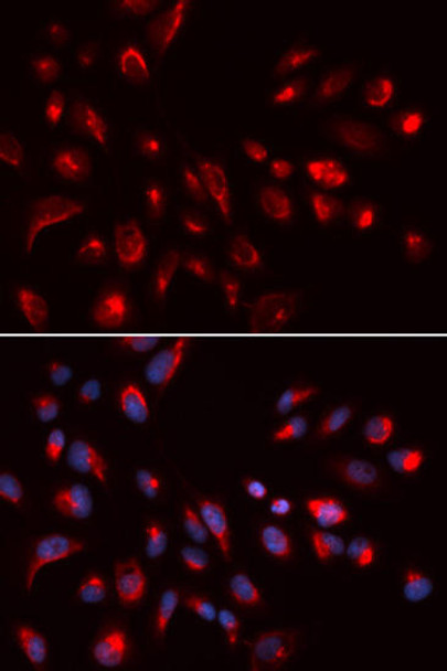 Cell Biology Antibodies 9 Anti-CHRM5 Antibody CAB5367