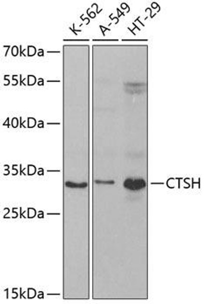 Cell Biology Antibodies 9 Anti-CTSH Antibody CAB5368